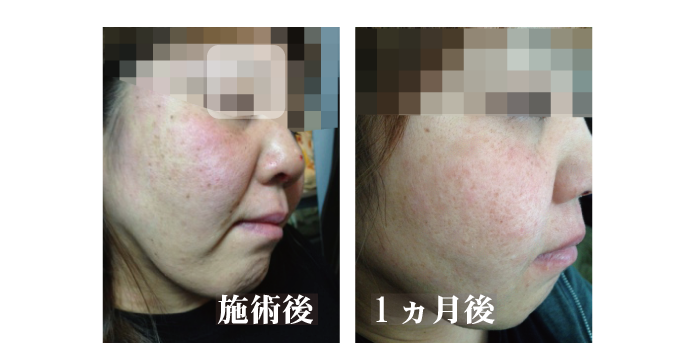 �G�X�e���j�^�[